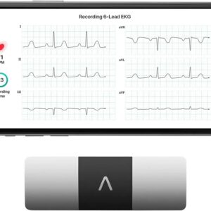 Personal EKG Monitor